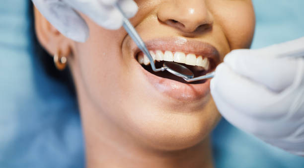 Best Same-Day Emergency Dental Services in South Amherst, OH